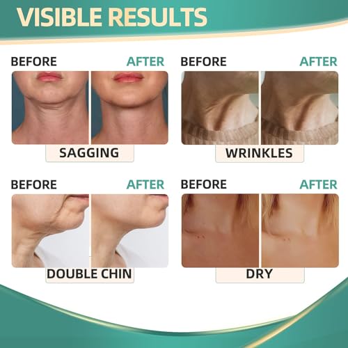 Neck Cream for Tightening Firming: Instant Face Lift Cream - Wrinkle Cream for Women RONKIE buy supplements canada