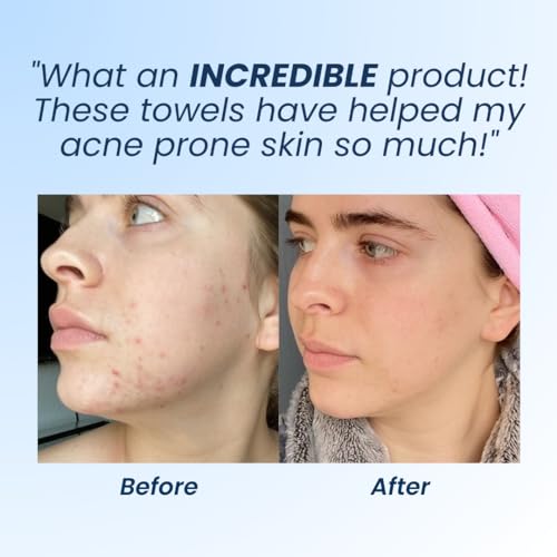 Clean Skin Club Clean Towels XL, Dermatologist Approved, 100% USDA CLEAN SKIN CLUB buy supplements canada