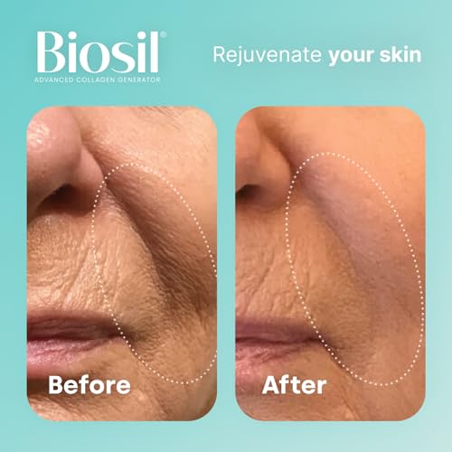 Biosil Collagen Generator - 120 Capsules - with Patented ch-OSA Complex - Generates & Protects BioSil buy supplements canada