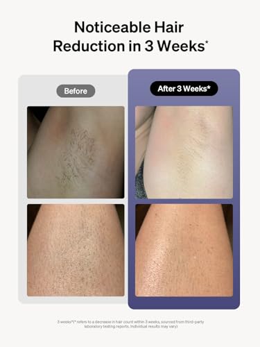 Ulike Laser Hair Removal for Women and Men, Air 3 IPL Hair Removal with Sapphire Ice-Cooling System Ulike buy supplements canada