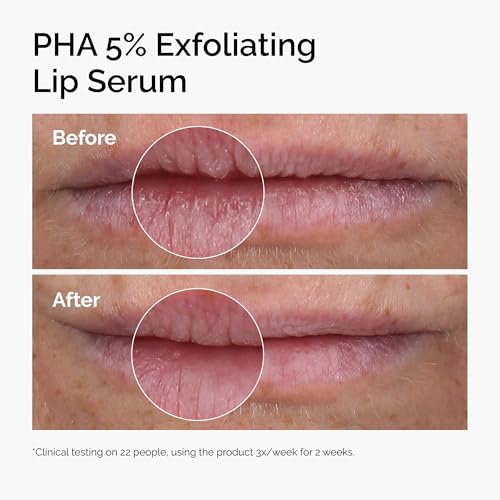 The Ordinary PHA 5% Exfoliating Lip Serum, Hydrating Overnight Lip Exfoliator Treatment, 0.5 Fl Oz The Ordinary buy supplements canada