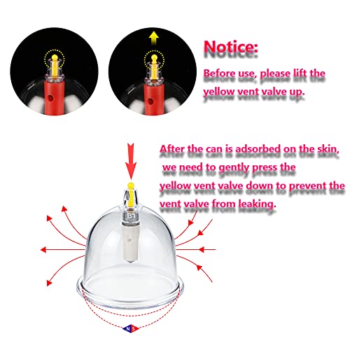 MYMM 12 Cupping Cups Sets Biomagnetic Traditional Professional Chinese Therapy Massage MYMM buy supplements canada