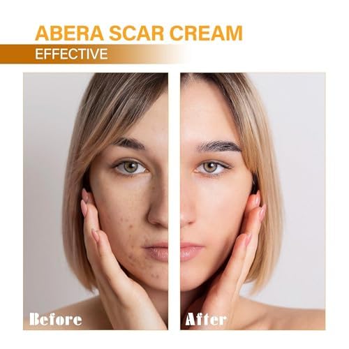 ABERA Scar Removal Cream for Women and Men - Rapid Repair of New Old Scars, Spots, Burns All Natural Treatment with Vitamin E, Alanine, Collagen (1 Box + 3 Eye Patch) ABERA buy supplements canada