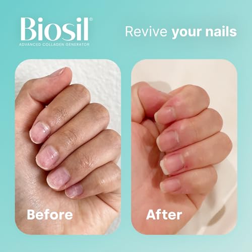 Biosil Collagen Generator - 60 Capsules - with Patented ch-OSA Complex - Generates & Protects Your Own Collagen BioSil buy supplements canada