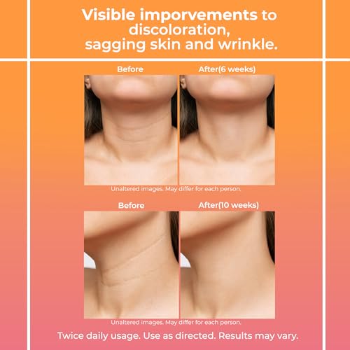 Neck Firming Cream for Women: Neck Cream - Neck Tightening Cream - Neck Creams Lemcuh buy supplements canada