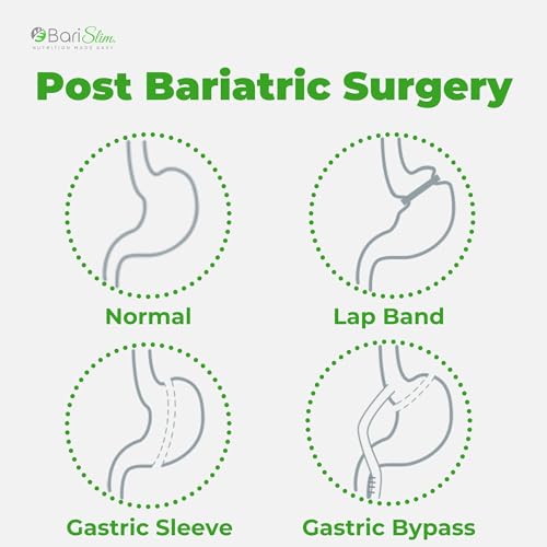 BariSlim Bariatric Calcium Citrate with Magnesium and Vitamin D Tabs - 500 mg of Calcium BariSlim buy supplements canada