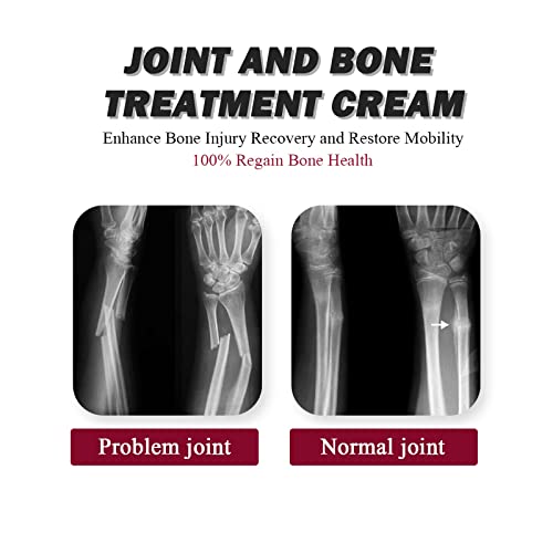Joint Collagen Relieves Joint Soreness And Body Joint Care Collagen Get Thick Products Generic buy supplements canada