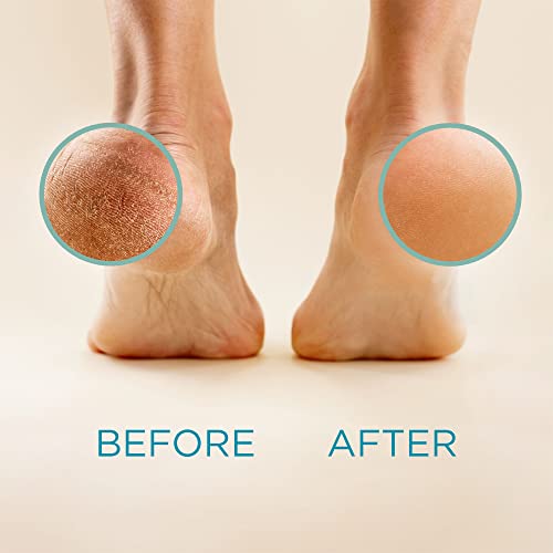Lee Beauty Professional Callus Remover for Feet - 8 Oz, Original, Powerful Lee Beauty Professional buy supplements canada