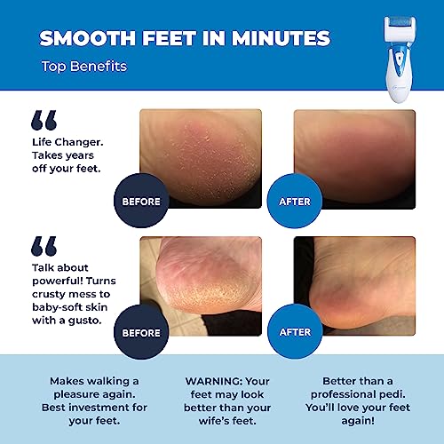 Electric Callus Remover: Own Harmony Professional Pedicure Tools Foot Own Harmony buy supplements canada