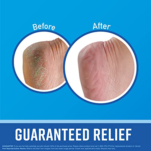 O'Keeffe's for Healthy Feet Foot Cream, Guaranteed Relief for Extremely Dry, Cracked Feet O'Keeffe's buy supplements canada