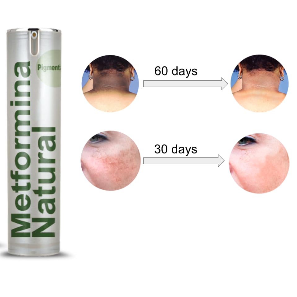 Ni una dieta más METFORMINA NATURAL - Cream for Dark Spots on Face and Body Ni una dieta más buy supplements canada
