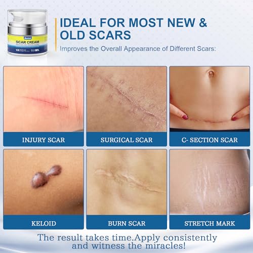 BORMSI Scar Cream,Active Silicone Dimethicone Scar Gel-Advanced BORMSI buy supplements canada