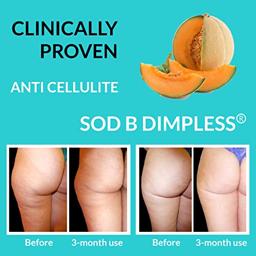 UpNourish Anti Cellulite Supplements - Varicose Veins Support, Restless Leg Relief UpNourish buy supplements canada