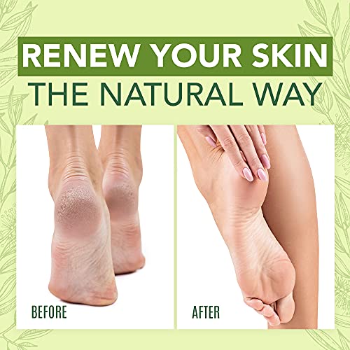 Tea Tree Oil Foot Cream For Dry Cracked Heels Repair - Natural Foot Cream For Dry Cracke USA Naturals buy supplements canada