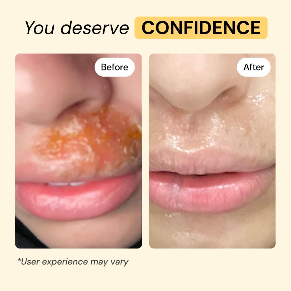 MyMagicHealer Universal Flare Care | Essential Oil Free | Baby Dermatitis, Diaper Rash, Eczema, Psoriasis, Impetigo | Wound Car MyMagicHealer buy supplements canada