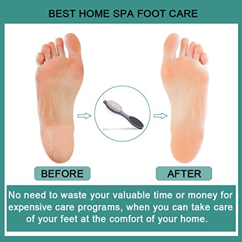CAREHOOD Foot File Callus Remover - Multi Purpose 4 in 1 Feet Pedicure CAREHOOD buy supplements canada