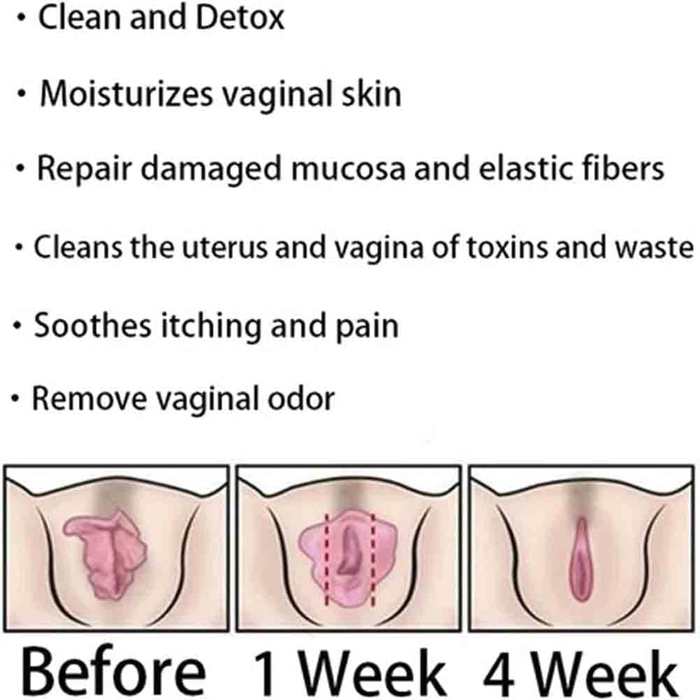 Natural Repair Vagianal Capsules, Anniecare Instant Anti-Itch Detox Slimming Products GDSAFS buy supplements canada