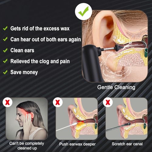 Upgraded Ear Wax Removal,Water Powered Ear Cleaner,Ear Cleaning Kit Alledge buy supplements canada
