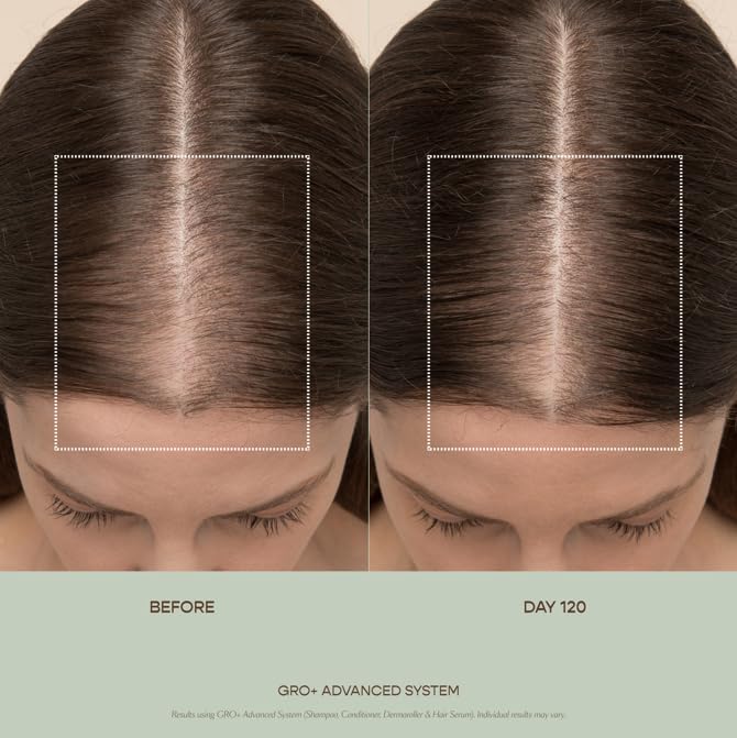 VEGAMOUR GRO+ Advanced Essentials Kit | Removes Buildup, Improves Hair Density, Reduces Shedding, Hydrates and Exfoliates the Scalp | For Severe Signs of Thinning | Color Safe, Vegan, Cruelty-Free VEGAMOUR buy supplements canada