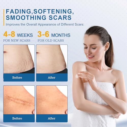 BORMSI Scar Cream,Active Silicone Dimethicone Scar Gel-Advanced BORMSI buy supplements canada