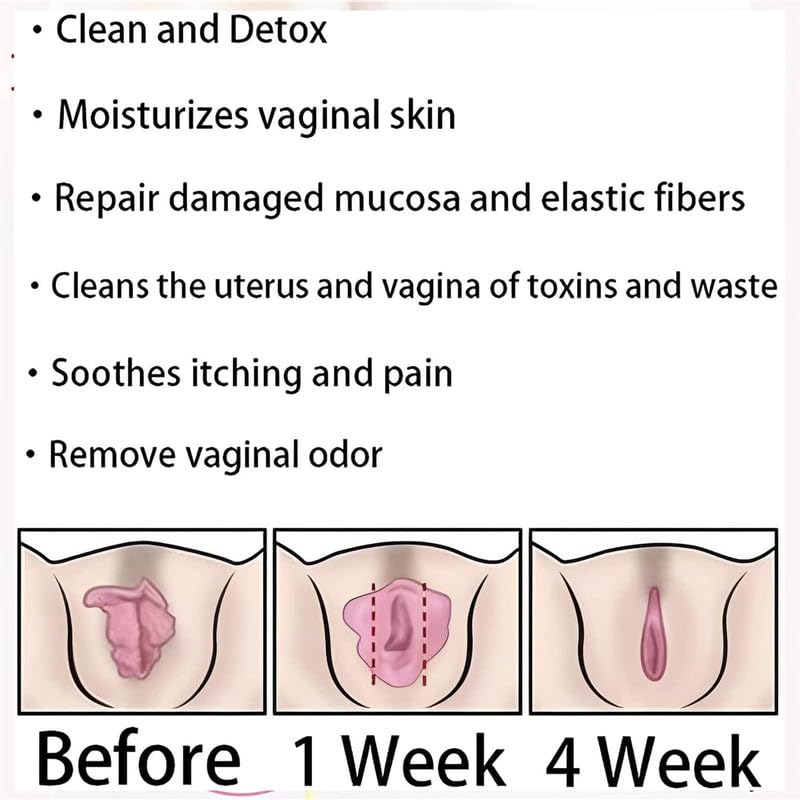 tsoneoo Dexcara Detox Repair - Natural Repair Vagianal Capsules, Natural Repair Vajinal Capsules tsoneoo buy supplements canada