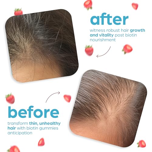 Artnaturals Biotin Gummies for Hair Growth - (100 Gummies - 10000mcg) - Natural Strawberry Artnaturals buy supplements canada