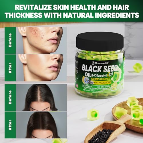 Sugar Free Black Seed Oil Filled Gummies & Chlorophyll, with Hydrolyzed Collagen EnvyCure buy supplements canada