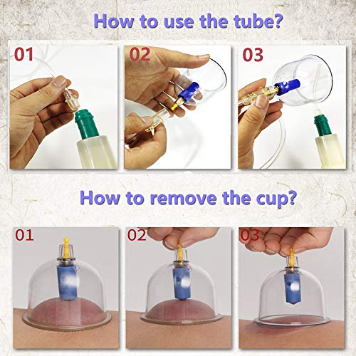 MYMM 12 Cupping Cups Sets Biomagnetic Traditional Professional Chinese Therapy Massage MYMM buy supplements canada