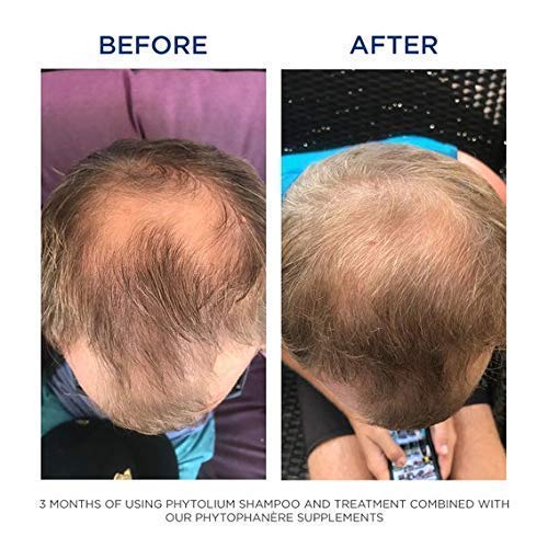 PHYTO Phytophanère 100% Natural Hair Loss Thinning Dietary Supplement PHYTO buy supplements canada