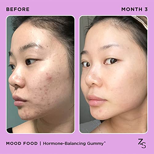 ZitSticka Mood Food: Gummy for Moody Skin + PMS Drama, Forest Berry Flavour ZitSticka buy supplements canada