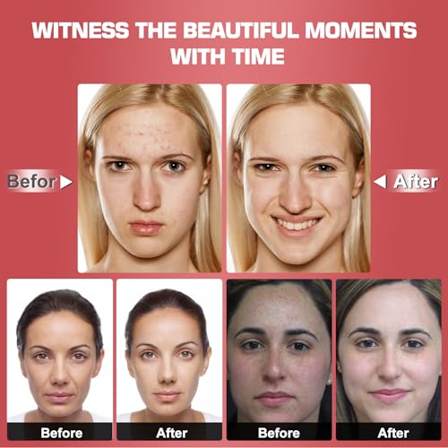 Red Light Therapy M-Ask Red Light Facial M-Ask Red Light Therapy for Face 7-1 Colors Light for Face Home Use LORICK buy supplements canada