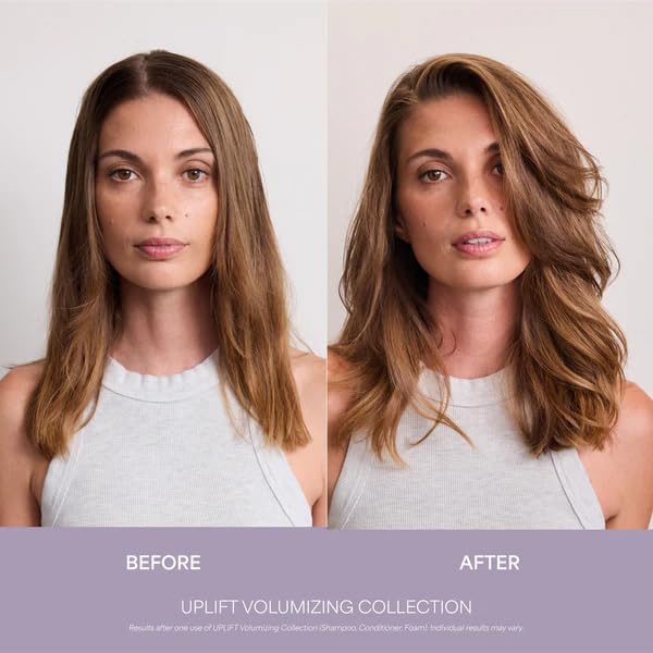 VEGAMOUR UPLIFT and Refresh Kit | Volumizing Dry Shampoo Spray Formulated Without Benzene, Supports Thicker Fuller Looking Hair | $50 Value VEGAMOUR buy supplements canada