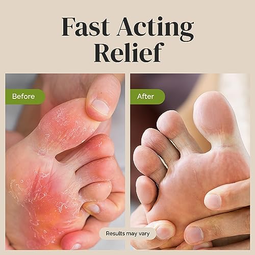 Puriya Tea Tree Oil Antifungal Cream, Plant-Powered Athletes Foot Cream Treatment Puriya buy supplements canada