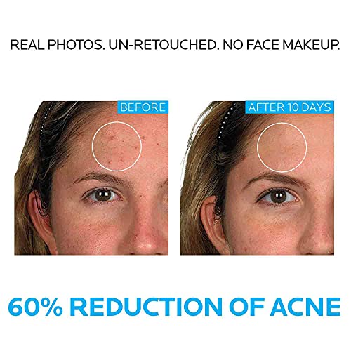 La Roche-Posay Effaclar Dermatological 3 Step Acne Treatment System La Roche-Posay buy supplements canada