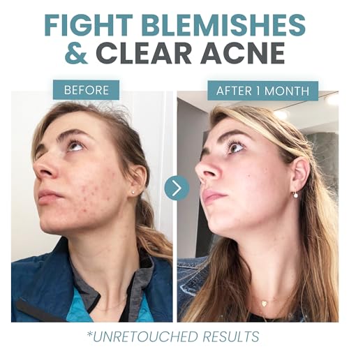 Eva Naturals Vitamin C Face Serum With Hyaluronic Acid - Anti Aging Serum Eva Naturals buy supplements canada