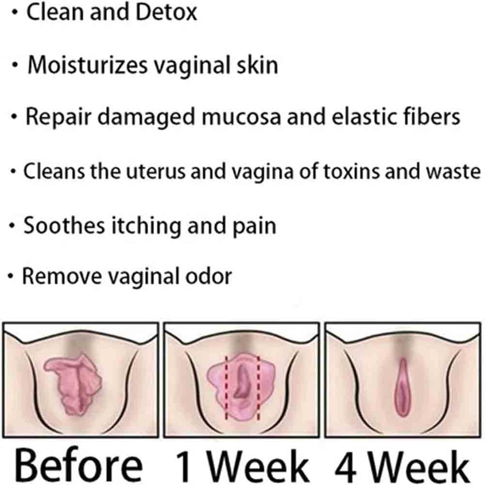 AnnieCare Instant Anti-Itch Detox Products, Annie Care Capsulas, Firming Repair & Pink Weabet buy supplements canada