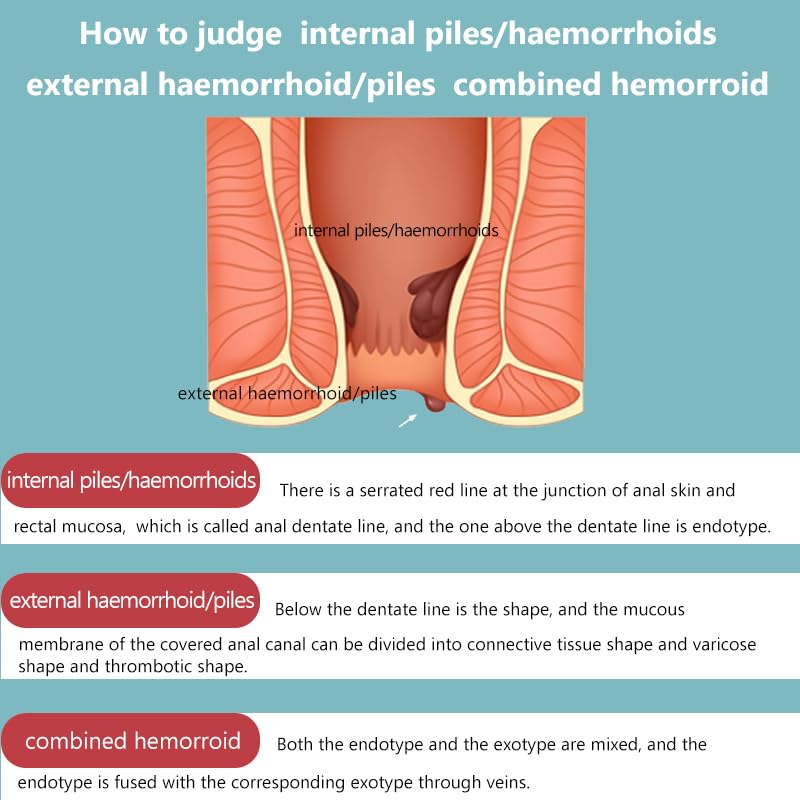 SERYNTH Hemorrhoid and Anal Fissure Ointment, Hemorrhoid Treatment, Fast Relief from Swelling, Pain, Itching, Burning (20g) SERYNTH buy supplements canada
