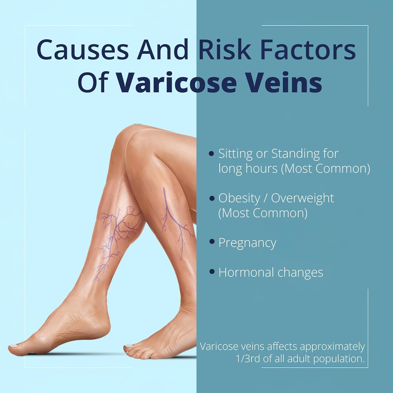 Cream Ayurvedic Solution for Management of Varicose Veins, Spider Veins, Varicocele Helps Reach The Root Cause of varicose Veins Reduces Cramps, Itching & Swelling. Single Tube (25 GMS). Generic buy supplements canada