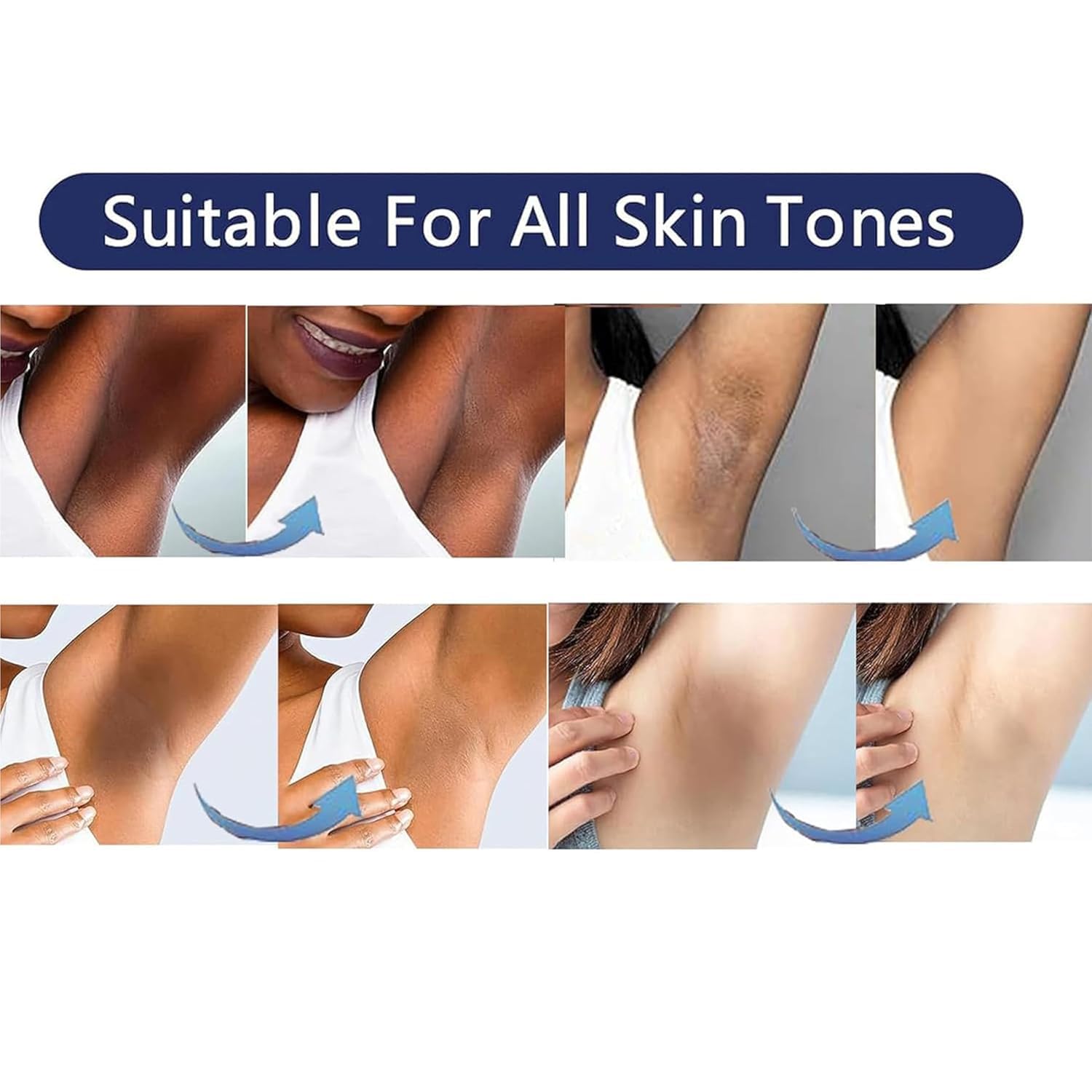 Vcetree Skin Bleaching Cream Skin Lightening for Body Intimate Areas, Private Parts, Underarm, Knees, Elbows, Inner Thigh, Bikini Area Vcetree buy supplements canada