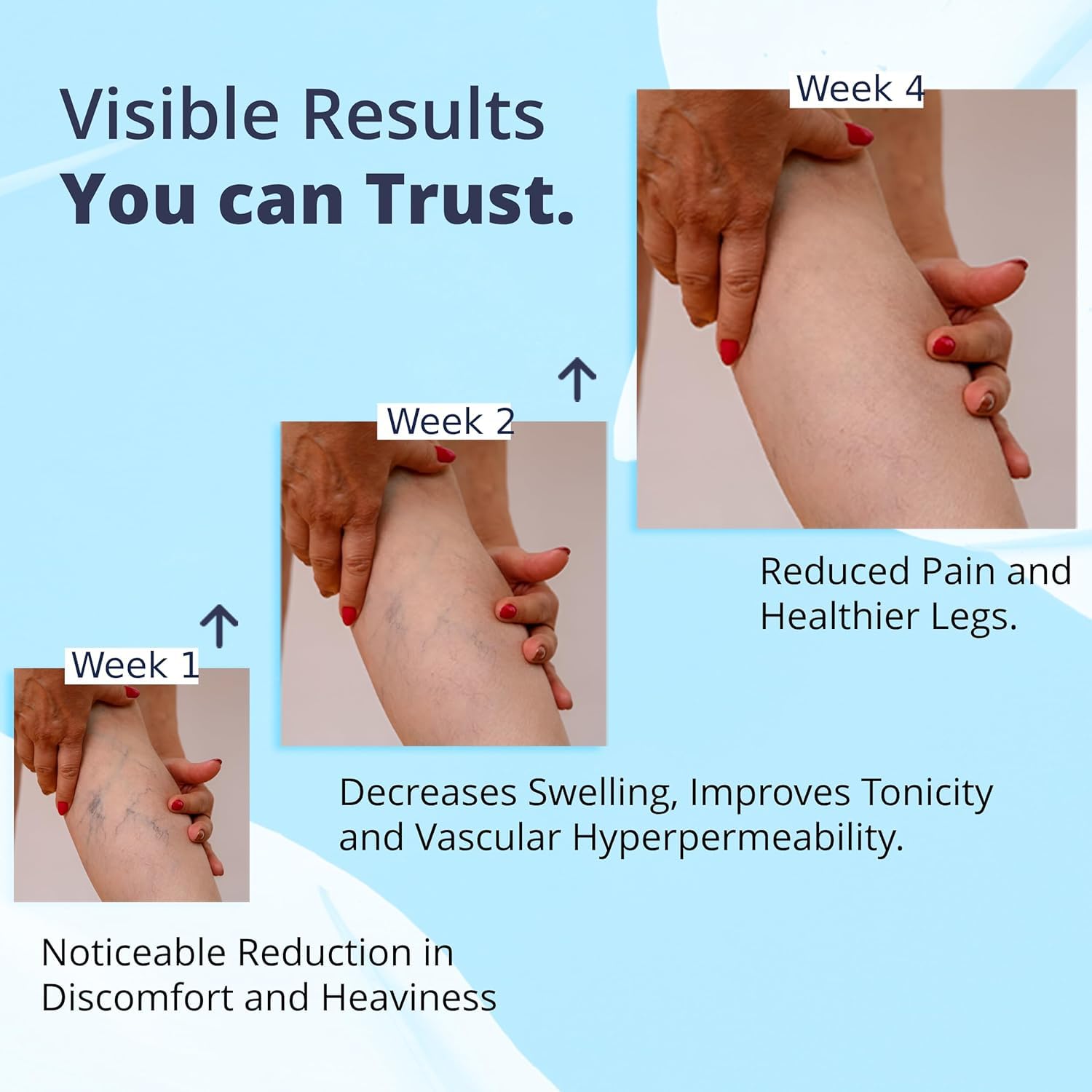 Cream Ayurvedic Solution for Management of Varicose Veins, Spider Veins, Varicocele Helps Reach The Root Cause of varicose Veins Reduces Cramps, Itching & Swelling. Single Tube (25 GMS). Generic buy supplements canada