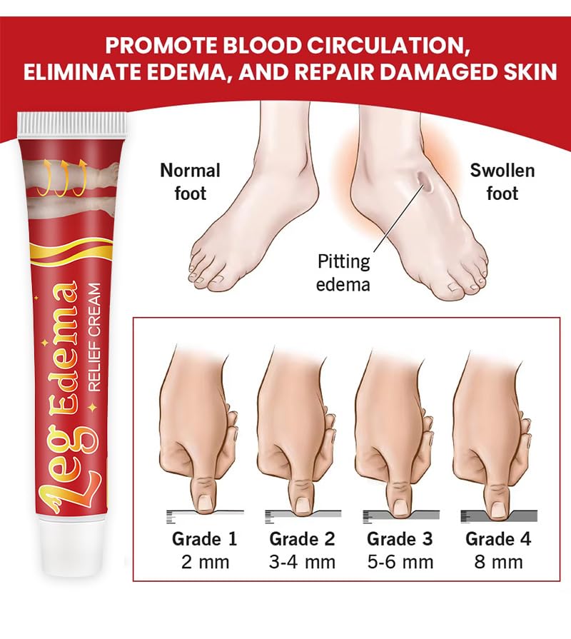 Leg Slimming Massage Cream | Soothing Swelling, Tightening Skin, Auxiliary Care for Reducing Edema （2 Pieces） bobojuju buy supplements canada