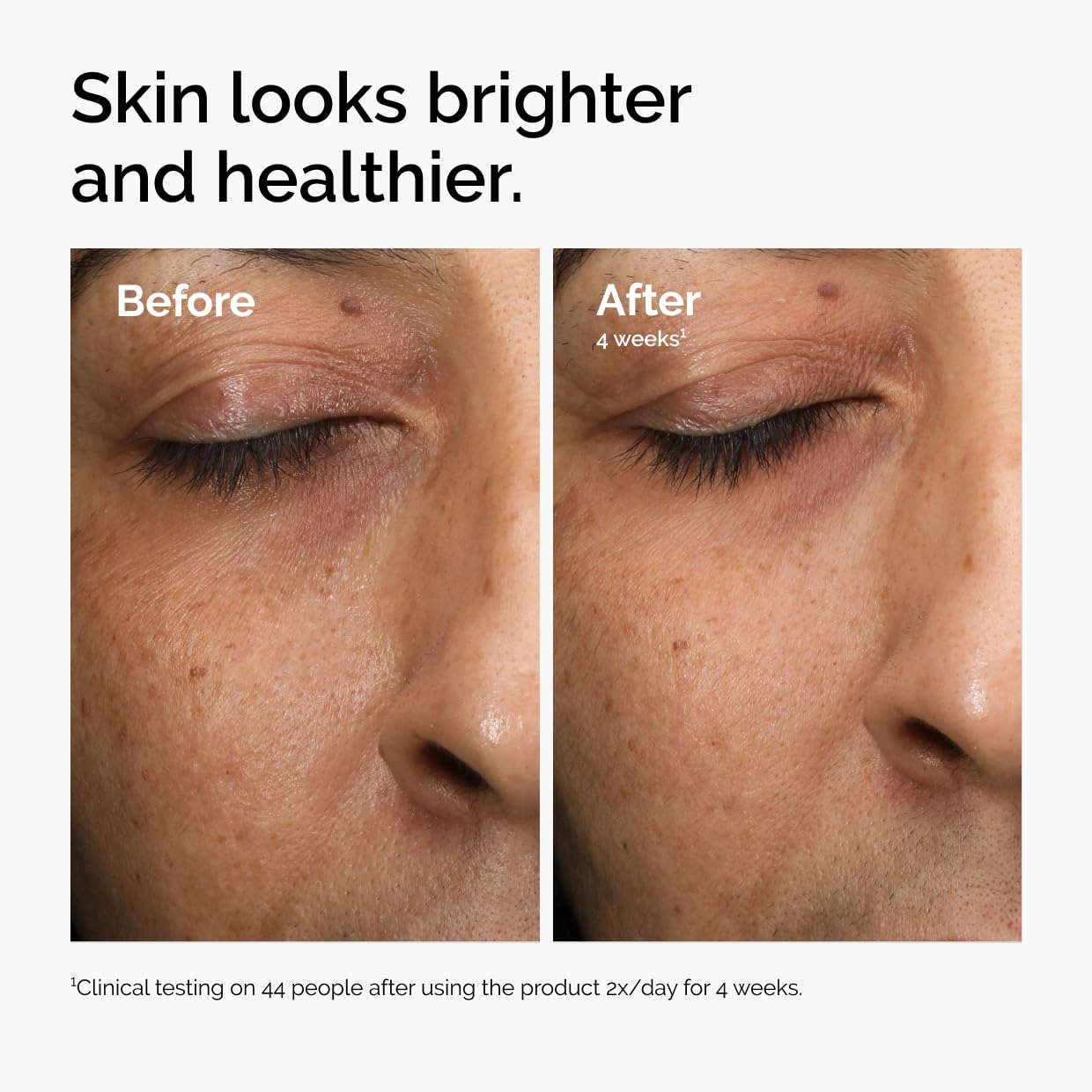 The Ordinary Multi-Antioxidant Radiance Serum, Vitamin C Serum For Face, Brighten & Protect Skin – Boosts Glow The Ordinary buy supplements canada