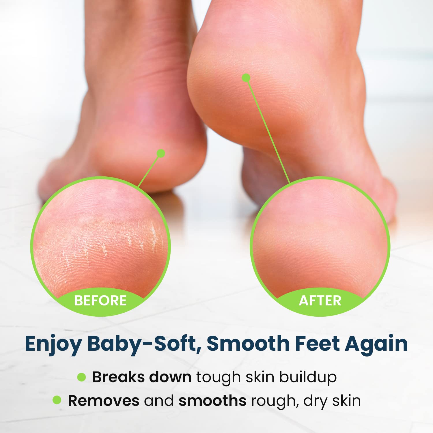 Toenail Fungus Treatment Extra Strength - Advance nail fungus treatment for fingernails FOOT CURE buy supplements canada
