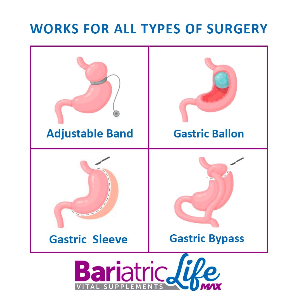 Bariatric Multivitamin Design for Post Bariatric Surgery Mens Patients, Sugar Free, 100+ Vitamins, Minerals & Amino Acids, Supports Muscle, Heart Bariatric Life Max buy supplements canada