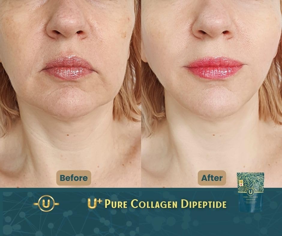 U+ Pure Collagen Dipeptide Supplement - Advanced Hydrolyzed Collagen Powder for Skin, Hair U+ Pure Collagen buy supplements canada