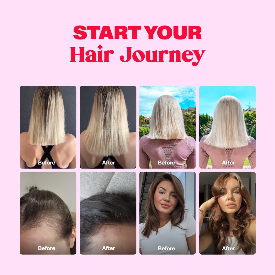 Bloom Robbins 60 Hair Gummies for Faster Hair Growth Vitamins for Women & 5000 MCG Bloom Robbins buy supplements canada