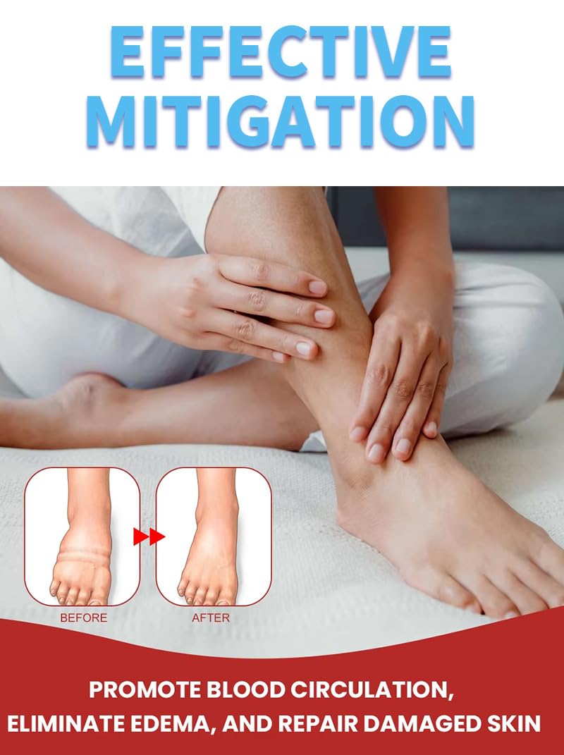 Leg Slimming Massage Cream | Soothing Swelling, Tightening Skin, Auxiliary Care for Reducing Edema （2 Pieces） bobojuju buy supplements canada