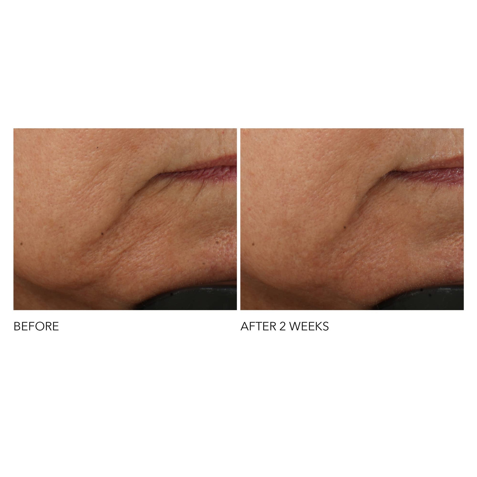 Dr Dennis Gross Advanced Retinol + Ferulic Intense Wrinkle Cream | Intensely Hydrating to Visibly Transform Skin and Repair the Moisture Barrier | 2 oz Dr Dennis Gross buy supplements canada