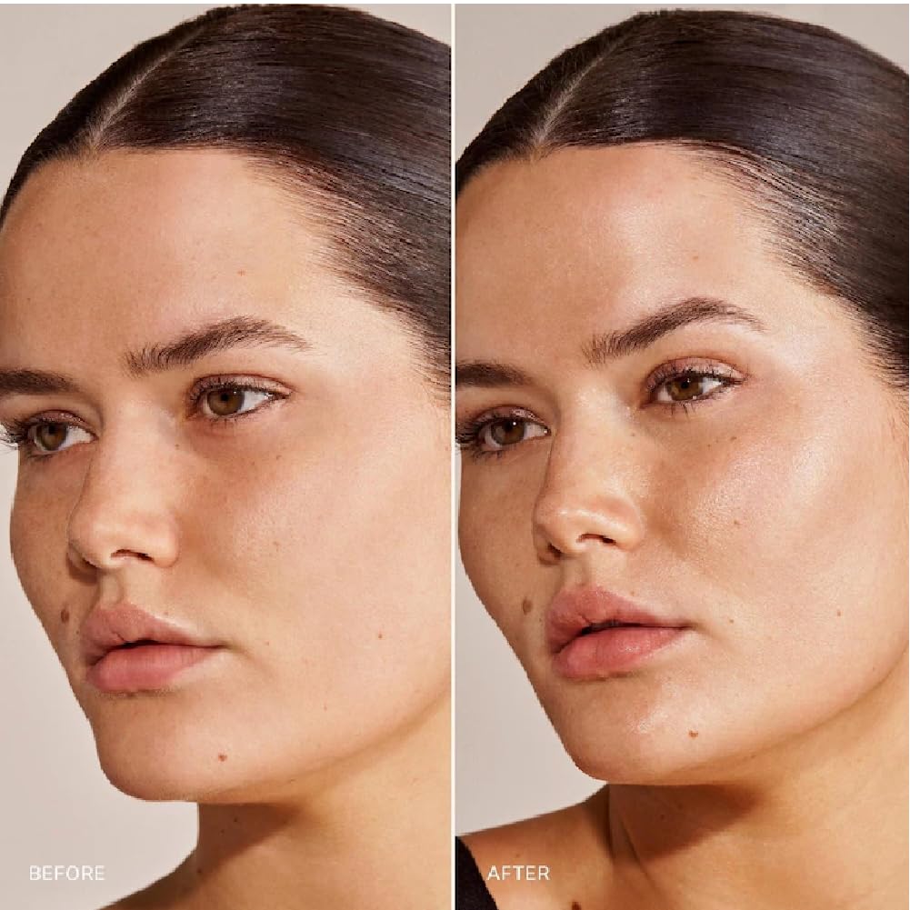 M Great Skin Instant Glow Serum with Niacinamide and Hyaluronic Acid (1.69 oz / 50 ml) + Bonus Acne Patch (36 Pieces) Tea Tree Oil Facial Water Gel NAPH buy supplements canada