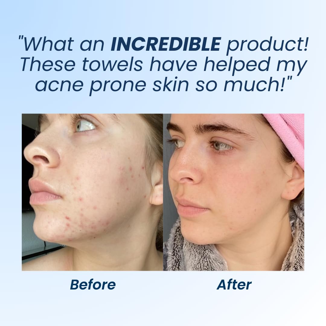 Clean Skin Club Clean Towels XL, Biodegradable Dermatologist Approved CLEAN SKIN CLUB buy supplements canada